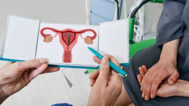 Vajinoplasti Ameliyatı İyileşme Süreci Hakkında Bilinmesi Gerekenler