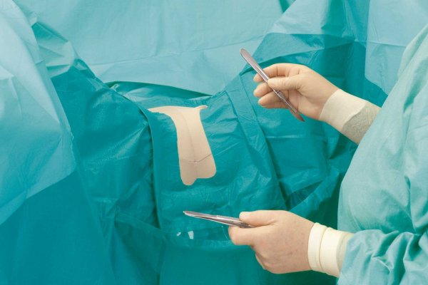 Vajina toparlama ameliyatı nedir ? Nasıl yapılır?